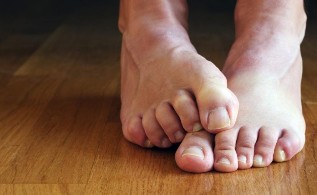 The reasons for the emergence of fungal nail