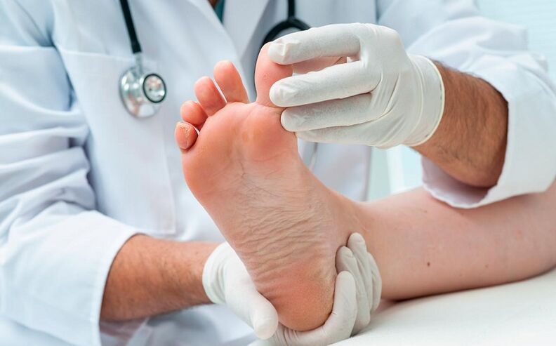 how and how to deal with foot fungus