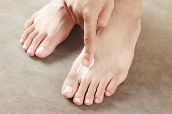 application of ointment from the skin fungus on the feet